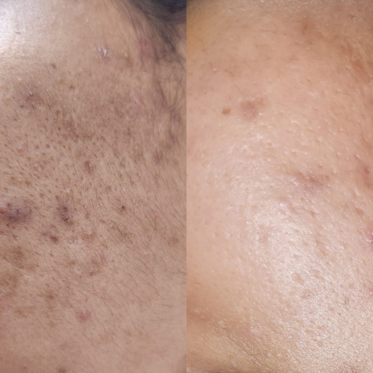 JUJU's Fresh Leaf Purify Facewash 100 ml - Image 3